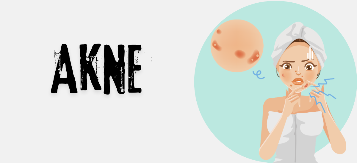akne