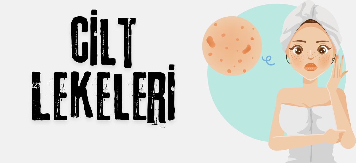 Cilt Lekeleri