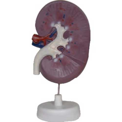 ESMAY BÖBREK